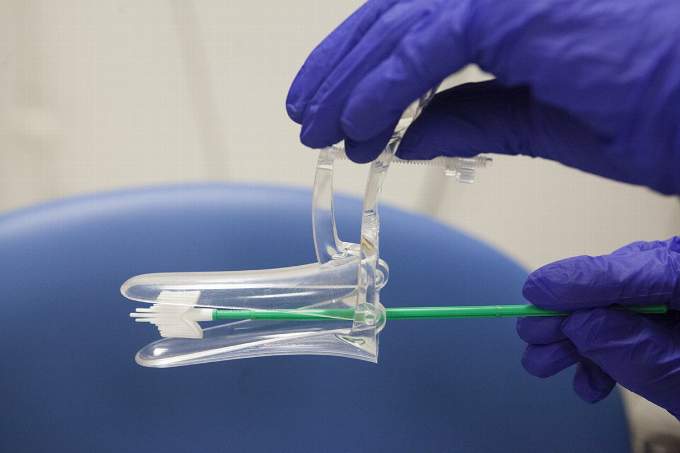 South West NHS aims to eliminate cervical cancer by 2040