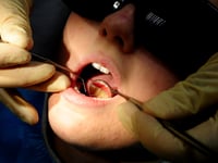 Dozens of hospital admissions in South Hams to remove children's rotten teeth