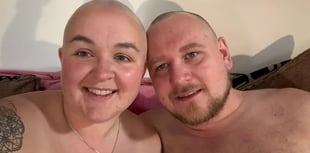 Chloe Smith faces alopecia, GoFundMe nears goal