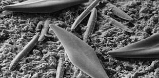 Nature Diary by Nigel Mortimer | Healthy Estuarine Scum?!